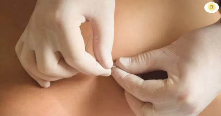 Acupressure Kya Hota Hai